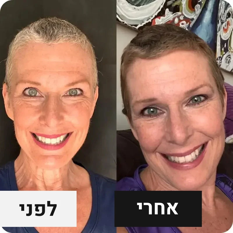 שיער קצר, לפני ואחרי